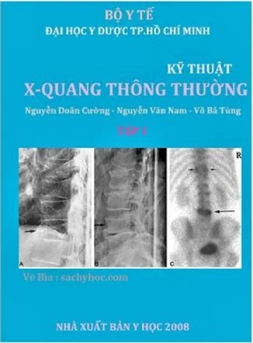 Kỹ Thuật X Quang Thông Thường – Giáo Trình Chính Thức Y Khoa Huế 2007