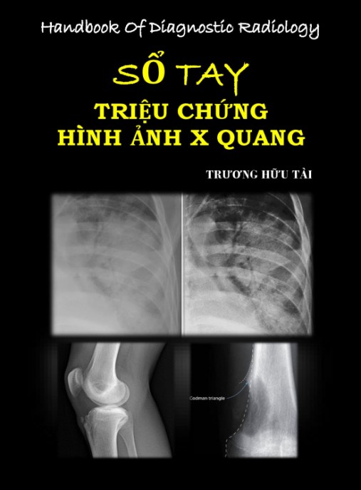 Sổ tay Triệu chứng hình ảnh X quang – Hướng dẫn chẩn đoán chuyên sâu