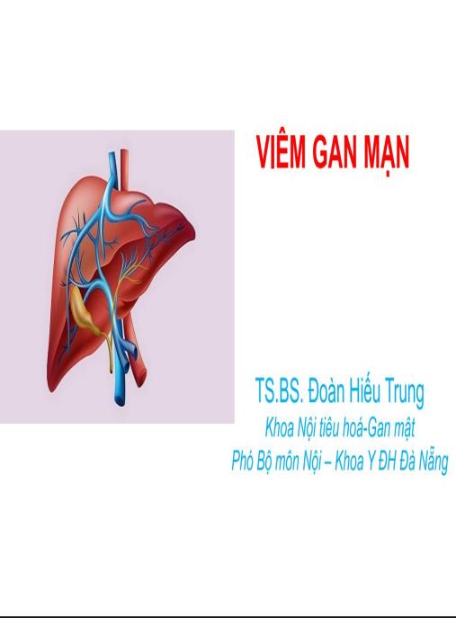 Bài giảng Viêm gan mạn – Tài liệu y khoa chuyên sâu nhất