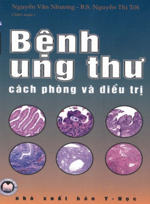 Bệnh Ung Thư: Cách Phòng Và Điều Trị Hiệu Quả Từ Chuyên Gia
