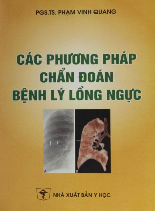 Các Phương Pháp Chẩn Đoán Bệnh Lý Lồng Ngực – Hướng Dẫn Chẩn Đoán Siêu Chính Xác