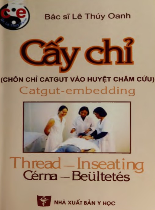 Cấy Chỉ (Chôn Chỉ Catgut Vào Huyệt Châm Cứu) – Bí Quyết Chữa Lành Kỳ Diệu