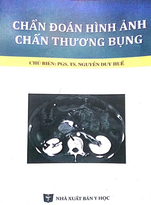 Chẩn Đoán Hình Ảnh Chấn Thương Bụng – Hướng Dẫn Chuyên Sâu Thiết Yếu