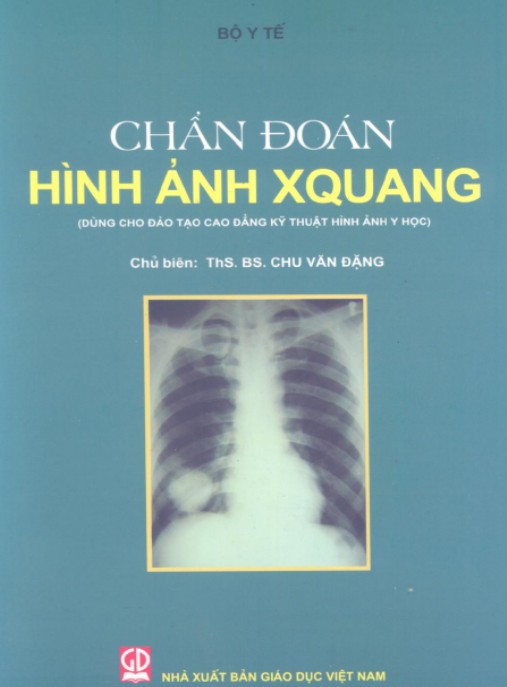 Chẩn Đoán Hình Ảnh X-Quang – Hướng Dẫn Chẩn Đoán Chính Xác