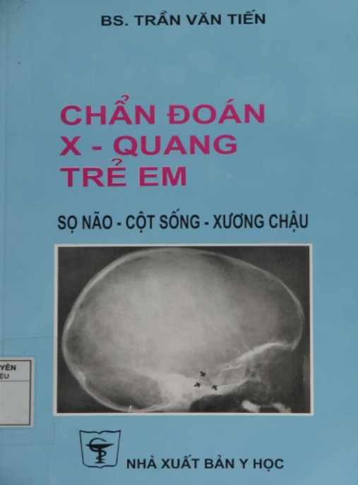 Chẩn Đoán X Quang Trẻ Em – Hướng Dẫn Chẩn Đoán Hình Ảnh Nhi Khoa Chuẩn Xác