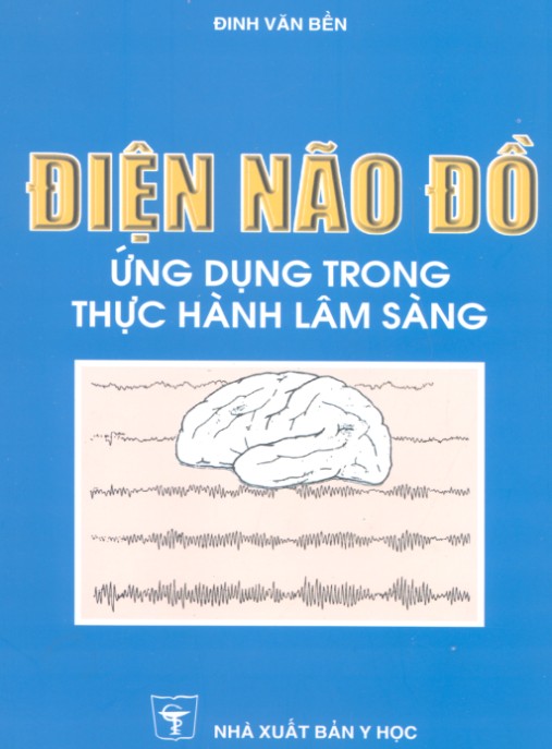 Điện Não Đồ Ứng Dụng Trong Thực Hành Lâm Sàng – Hướng Dẫn Chuyên Sâu Cho Bác Sĩ