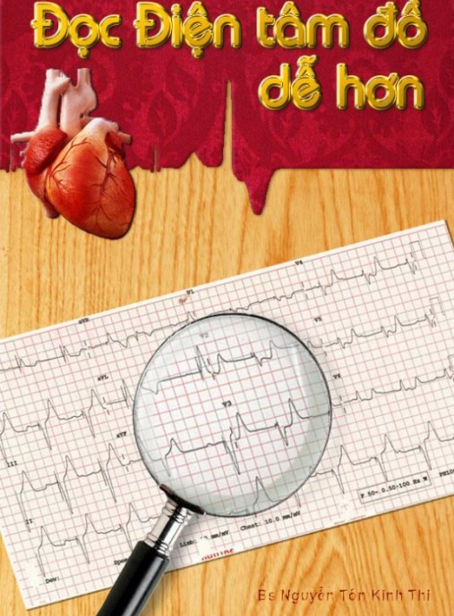 Đọc Điện Tâm Đồ Dễ Hơn – Bí Quyết Đơn Giản Cho Người Mới Bắt Đầu