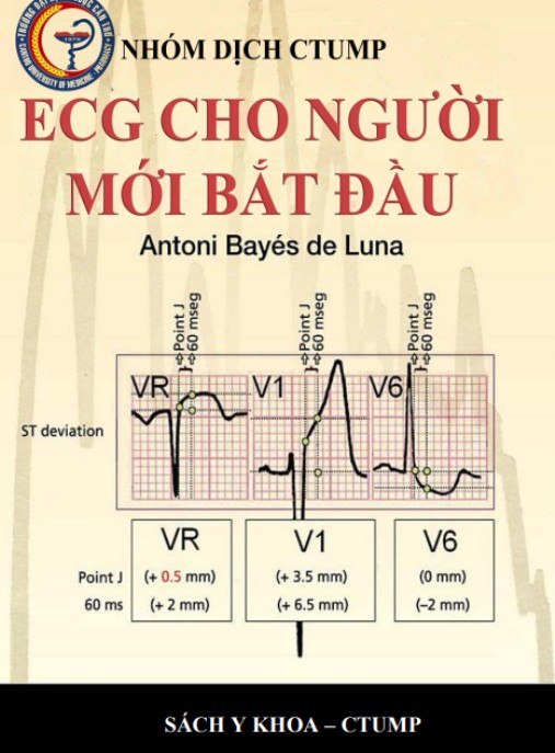 ECG Cho Người Mới Bắt Đầu – Hướng Dẫn Cơ Bản Siêu Dễ Hiểu!