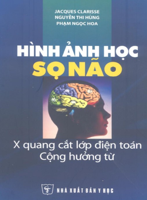 Hình Ảnh Học Sọ Não – Hướng Dẫn Chẩn Đoán Hình Ảnh Não Bộ Siêu Chi Tiết