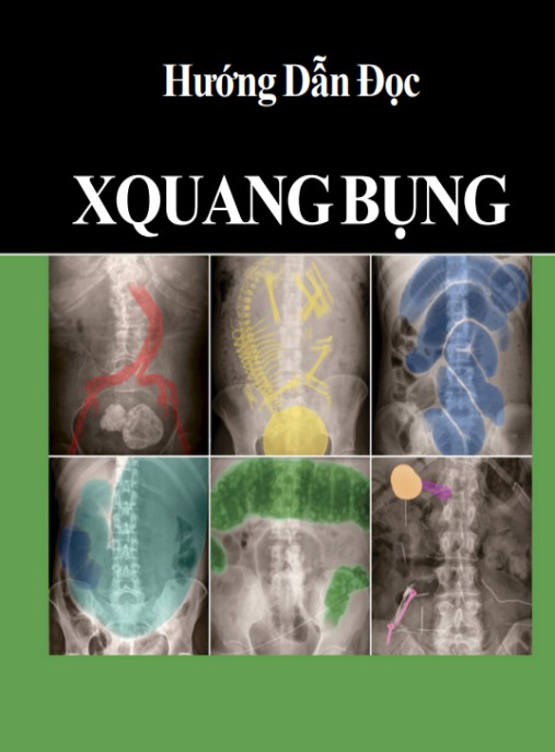 Hướng Dẫn Đọc X Quang Bụng – Bí Quyết Chẩn Đoán Siêu Chính Xác