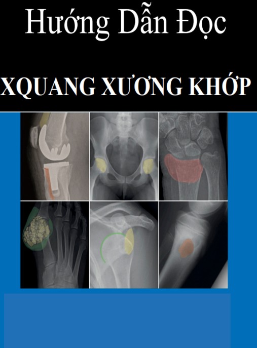 Hướng Dẫn Đọc X Quang Xương Khớp – Bí Quyết Chẩn Đoán Siêu Chuẩn!