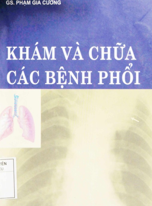Khám Và Chữa Các Bệnh Phổi – Hướng Dẫn Toàn Diện Từ Chuyên Gia