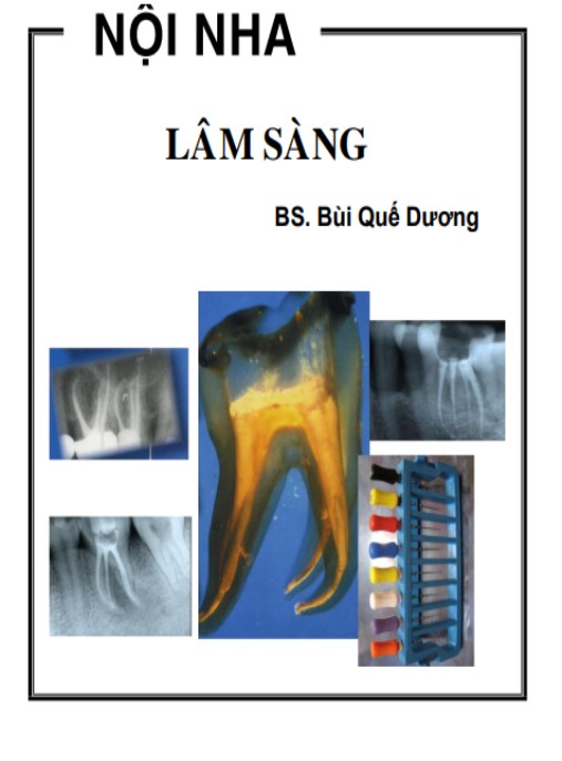Nội Nha Lâm Sàng – Hướng Dẫn Lâm Sàng Chuẩn Y Khoa