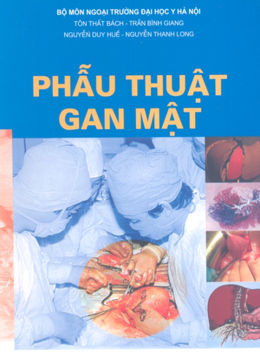 Phẫu Thuật Gan Mật – Hướng Dẫn Chuyên Sâu Cập Nhật Mới Nhất