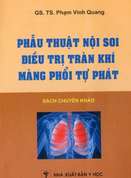 Sách Chuyên Sâu: Phẫu Thuật Nội Soi Điều Trị Tràn Khí Màng Phổi Tự Phát