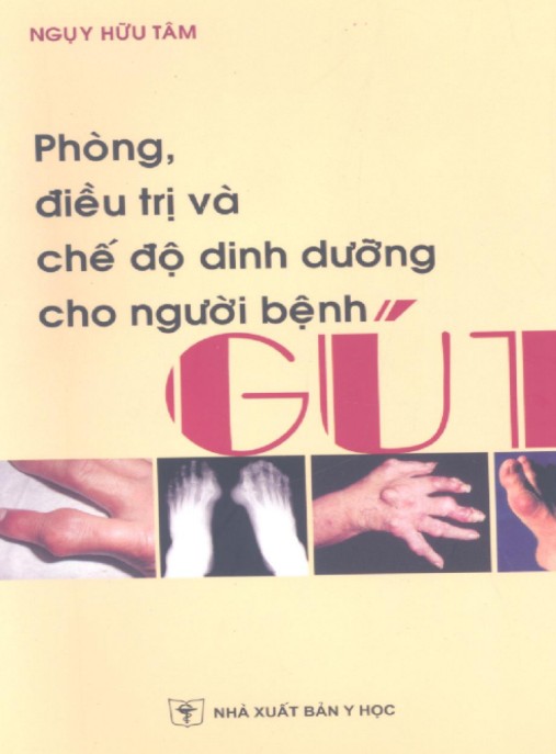 Phòng, Điều Trị Và Chế Độ Dinh Dưỡng Cho Người Bệnh Gút – Hướng Dẫn Toàn Diện