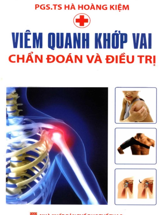 Viêm Quanh Khớp Vai Chẩn Đoán Và Điều Trị